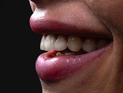 Perfect Your Smile: Expert Orthodontics Sydney Wide